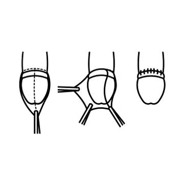 Circumcision line icon, vector illustration Stock Illustration