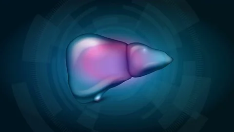 Cirrhosis of the Liver Stock Footage 69874215