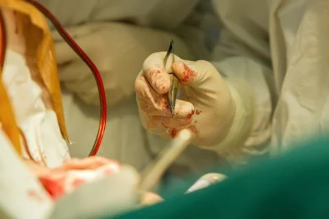 Clamp with a needle Stock Photos