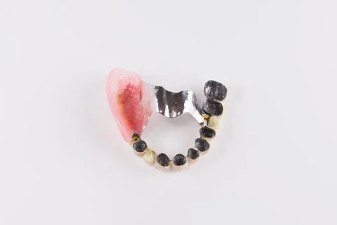 Clasp prosthesis with attachments fixing ceramic crowns Stock Photos