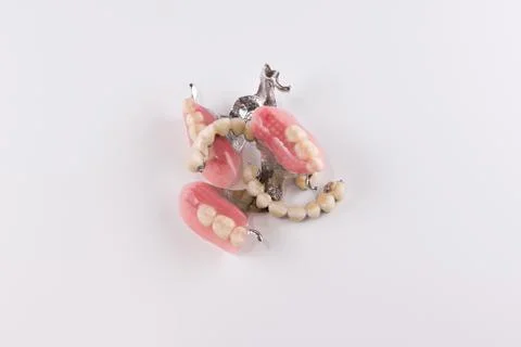 Clasp prosthesis with attachments fixing ceramic crowns Stock Photos