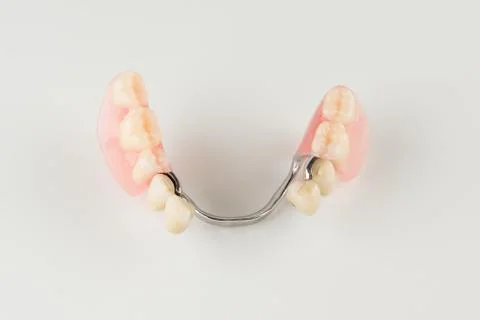 Clasp prosthesis with lock fixation Stock Photos