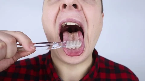 Clean tongue. Close-up of a man performing antimicrobial hygiene with a special  Stock Footage 177448703