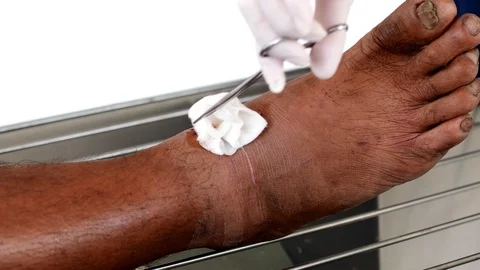 Cleaning sutured wound on knee Stock-Footage 90755422
