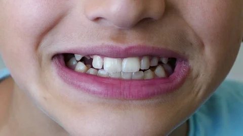 Cleaning teeth with miswak, a child using miswak, teeth and miswak, Video stock 118275822