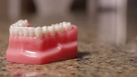 Clear aligner on a set of model teeth Video stock 113471625