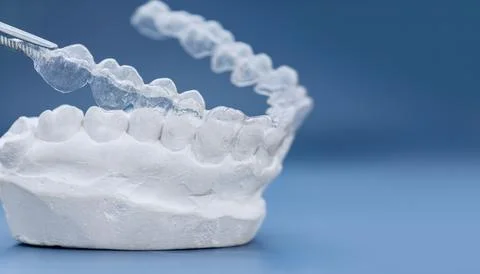 Clear Dental Aligner Placed On Plaster Model Fotos de archivo