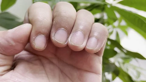 Clear Image of Asian Hand Nails - Left and Right Close View Video stock 279378022