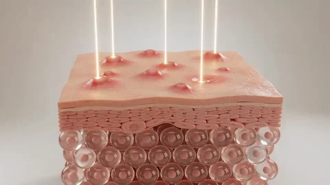 Clear Skin Transformation Animation. Stock-Footage 343230131