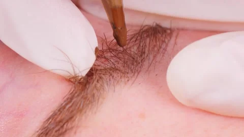 Client chooses permanent solution to sparse eyebrows Video stock 278317620