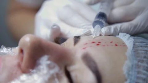 In the clinic, the cosmetologist performs a procedure to restore the processes Stock Footage 81105650