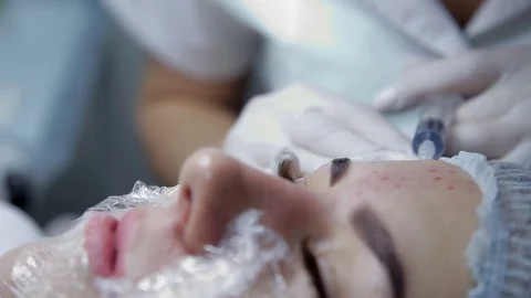 In the clinic, the cosmetologist performs a procedure to restore the processes Stock-Footage 81105702