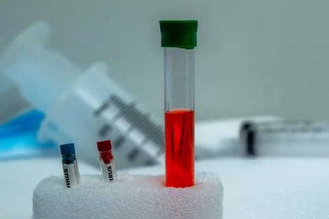 Clinical Analysis in Progress Test Tubes, Blood and Laboratory Equipment (1) Stock Photos