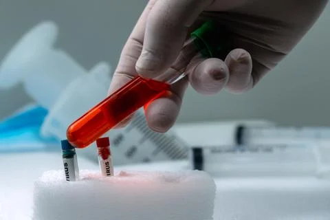 Clinical Analysis in Progress Test Tubes, Blood and Laboratory Equipment 2 Stock Photos