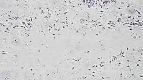 Clinical laboratory analysis of sperm cell deformities using high magnification Stock Footage 343961531