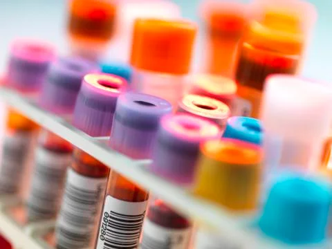 Clinical testing 库存照片