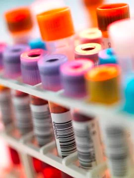Clinical testing 库存照片