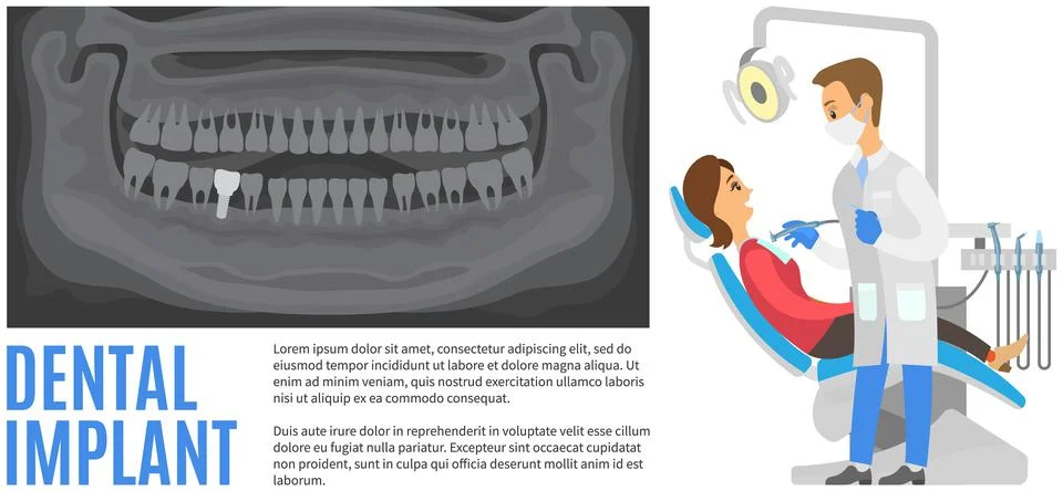 Clipping from article about dental implants, x-ray of healthy teeth. Woman Illustrazione stock