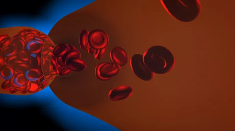 Clogged artery. Digital animation. Stock Footage 40623658