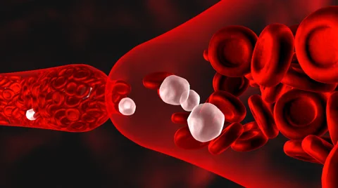 Clogged artery. Digital animation. Stock Footage 40623680