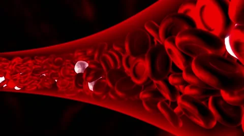 Clogged artery. Digital animation. Stock Footage 68991879