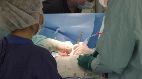 Close-up action plan during heart surgery. Stock Footage 137216231