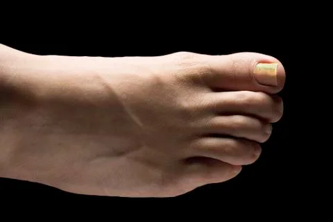 A close up and top view of a bare caucasian human foot, isolated against a bl Stock-Fotos