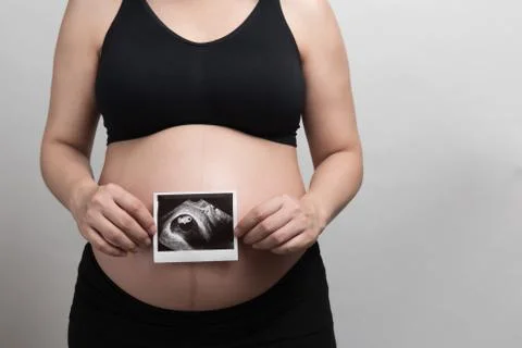 Close up Asian pregnant woman with black bra holding the ultrasound picture o Stock Photos