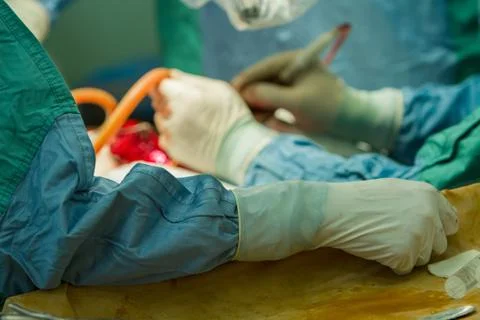 Close-up of the  assistant surgeon's hand. Stock Photos