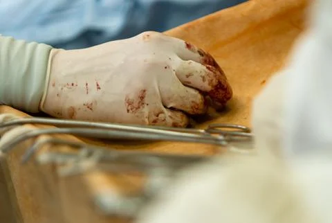 Close-up of the assistant surgeon's hand. Stock Photos