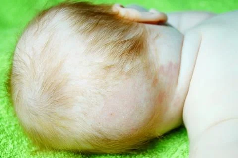 Close up of baby bald patch. Stock Photos