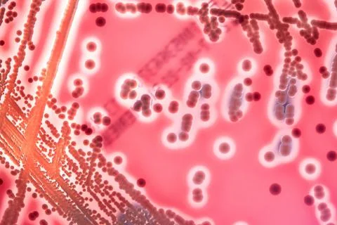 Close up of bacterias in petri dish sample. Bacterial culture in medical science Stock Photos