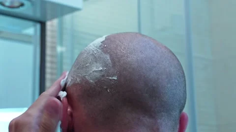 Close-up of a bald man applying shaving foam on his head to shave it with a Stock Footage 218959655