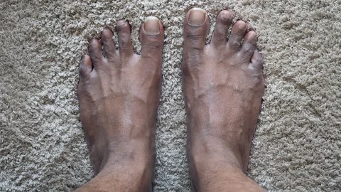 Close up of bare human feet standing on plush carpet showing skin texture a.. Stock Footage 332578936