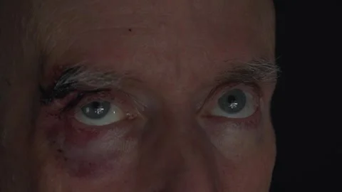 Close up of a beat-up man with a bruised and bloody eye Stock-Footage 269832169