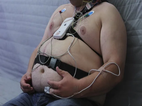 Close up of belly of very fat man with sensors on his body. Stock Footage 80054014