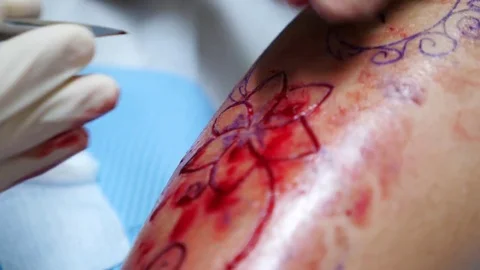 Close up on bleeding leg during scarification Stock Footage 74995298