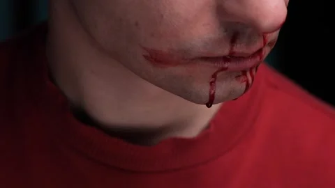 Close-up of bleeding man with blood dripping from mouth and nose Stock Footage 306800282