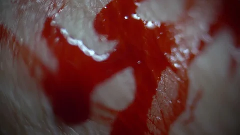 Close up of blood on skin Stock-Footage 120879559