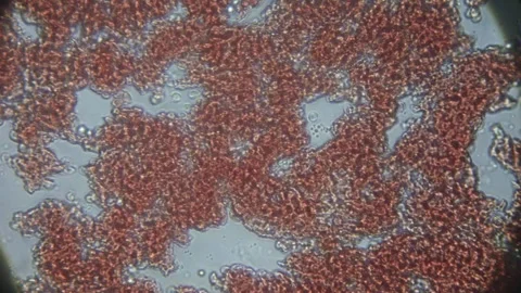Close-up of blood under a microscope, highlighting individual cells in moti.. Stock Footage 303573468