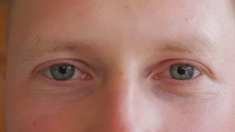Close up blue eyes of guy staring and blinking with a tired sight. Portrait Stock Footage 119635932