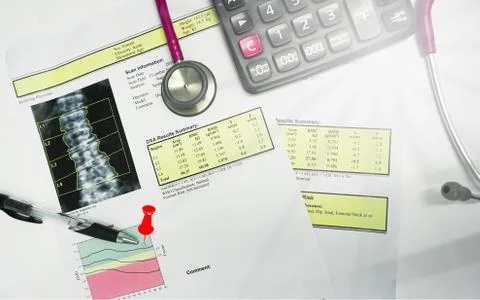 Close up Bone Densitometry Result on the table in room doctor.Healthcare and  Stock Photos