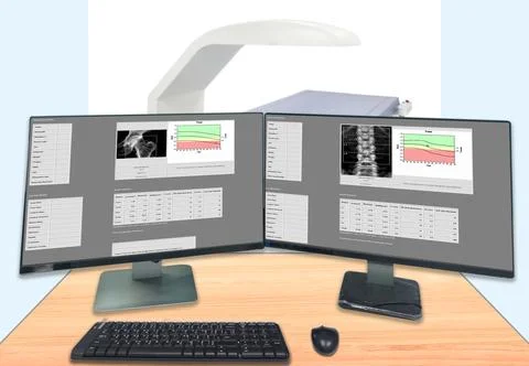 Close up Bone density machine,The X-ray department of hospital used for dia.. Stock Photos