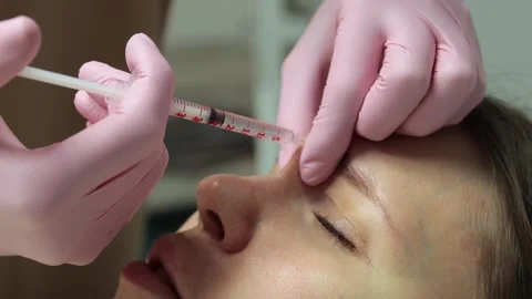 Close up of botulinum toxin injection in forehead Stock Footage 330531559