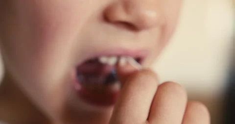 Close-up of a boy mouth with a string tied to his front baby tooth, which he is 스톡 동영상 323105390