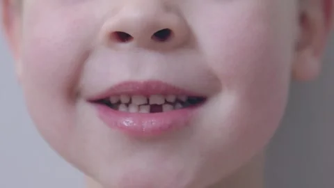 Close-up of boy showing his fallen milk tooth carefree essence of childhood and Video stock 281883489