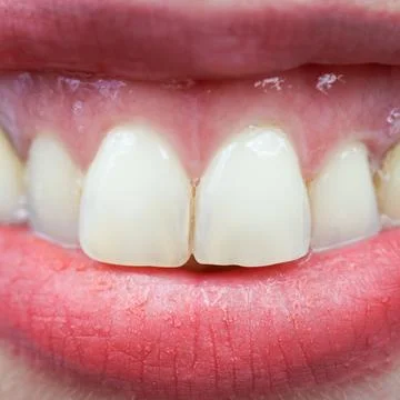 Close-up of bright, natural human teeth Stock Photos