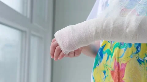 green arm cast