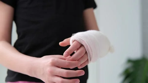 Close-up of a broken arm of a child in a cast. Stock Footage 173436672