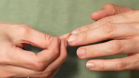 Close-up of a broken fingernail being picked with fingers Stock Footage 308607881